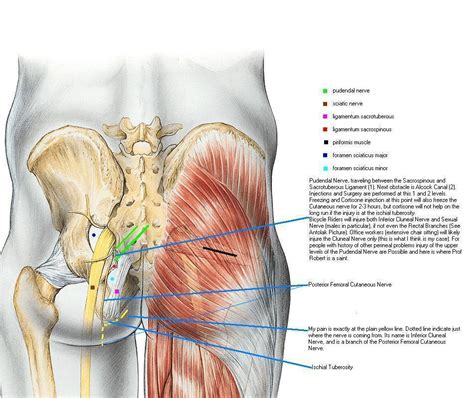 Low back pain (lbp) is encountered frequently in clinical practice. pelvis1_xxadrian_20020501_124818_rev_A.jpg (952×800 ...