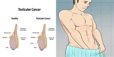 Genes tell our cells how to function. 5 Signs Of Testicular Cancer Most Men Are Too Embarrassed ...