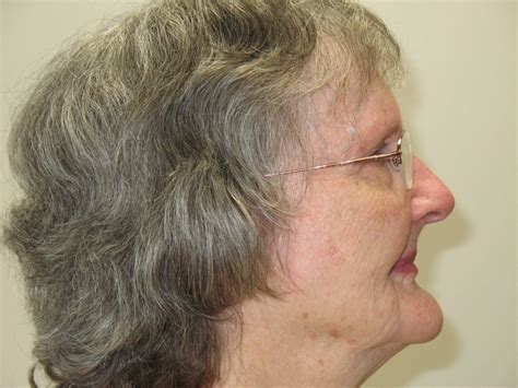 Orange Park, FL Dentist