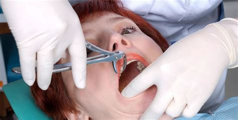 You will probably go home the same day of a tooth extraction. How Long Does It Take to Recover from a Tooth Extraction