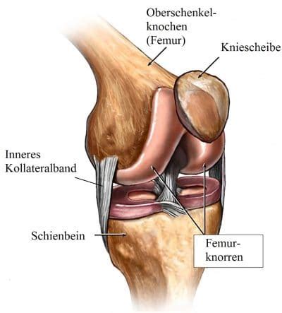 Doch nur im gemeinen leben. Innenbandriss des Kniegelenks, Tapen, Symptome, Schiene