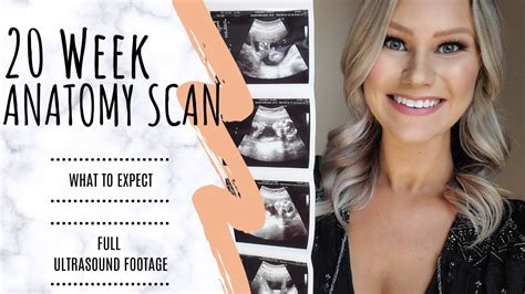 I had a scan at 7+4 and then 8 weeks exactly. 20 WEEK ANATOMY SCAN - What to Expect - My Experience ...