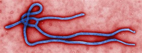 Second ebola outbreak confirmed in drc after four people die. Ebola