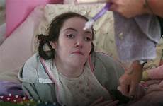 epilepsy disabilities scandal damaged playback unsupported