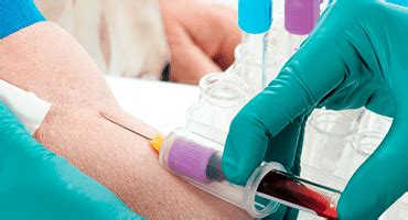 2 how did i get mono without kissing? Get Tested for Hepatitis C | Gastrointestinal Society