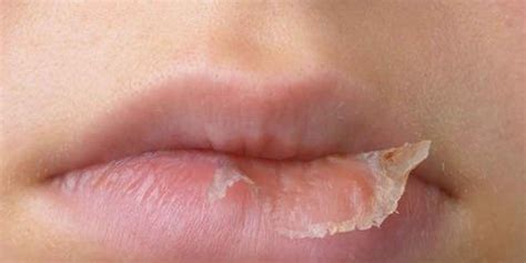 See more ideas about glossy lips, lips, aesthetic makeup. 3 Common Lip Balm Ingredients That Irritate Your Lips ...