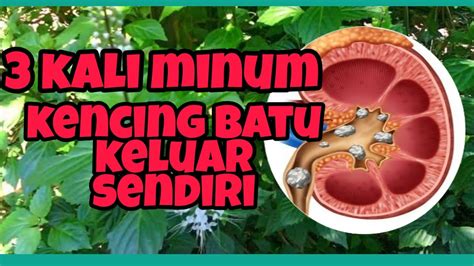 Kita sering lupa bahwa kunci sholat itu ada pada wudhu,apabila wudhunya tidak beres maka secara otomatis sholatnya tidak beres.wudhunya akan ditentukan dari. Ramuan alami mengobati kencing batu atau susah buang air ...