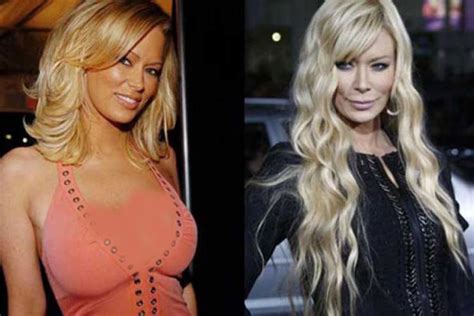 By 1996, she had won the three. Jenna Jameson Plastic Surgery: Nose job, Lips Fillers ...