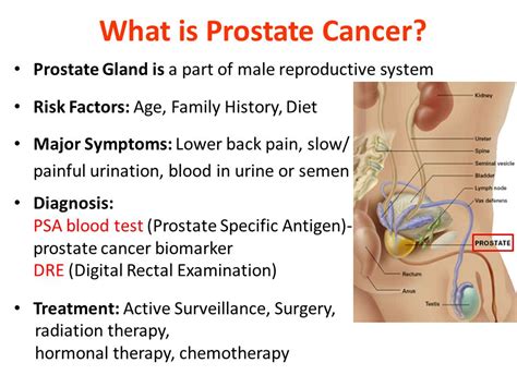 When prostate cancer spreads, it's common for cancer cells to. The Importance of Early Detection of Prostate Cancer - The ...