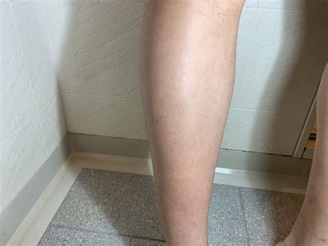 【除毛クリーム】ムダ毛の悩みを解消!高校生男子が初めて ...