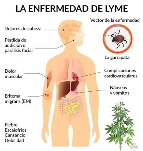 Es improbable que se produzca la infección de lyme si la garrapata ha estado adherida durante es importante que consultes con el médico incluso si los signos y síntomas desaparecen; El cannabis echa a al suelo a la enfermedad de Lyme ...