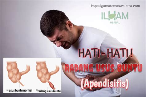 Lampiran adalah organ kecil yang terdapat di mana usus kecil dan besar bertemu. Pin di Obat Herbal Walatra Capsul