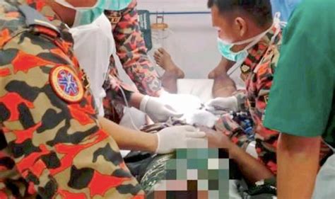 Bayak cara mengobati sakit gigi diantaranya obat sakit gigi. Derita 'anu' tersepit dalam lubang gigi daun gear | Kes ...