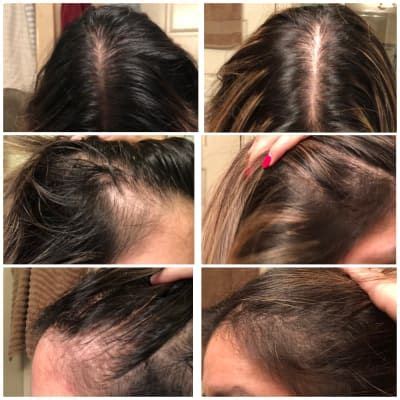 If your hair is lacking. Grow Gorgeous Hair Density Serum | Ulta Beauty | Micro ...