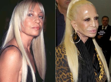 Under the Knife - 16 Celebs Who Took Plastic Surgery Too ...