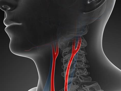 There are arteries in the neck as shown in the image. Arteries In Neck / Treatment For Carotid Artery Disease ...