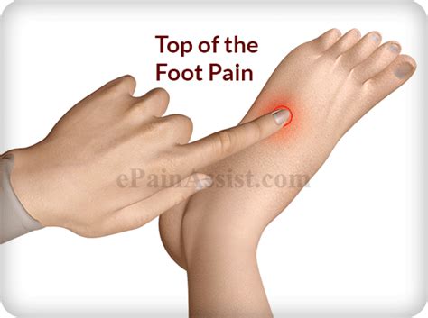 Could be any number of things as my poor left foot has been under attack. Top of the Foot Pain: Treatment, Exercises, Causes, Symptoms