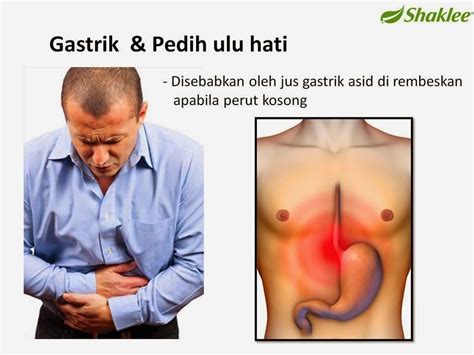 Adakah pengambilan susu baik untuk gastrik? Mommy Afnan: BAGAIMANA ESP MEMBANTU MASALAH GASTRIK ANDA