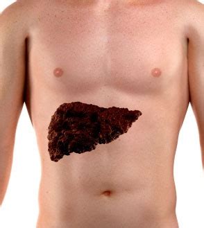 Fever is very common symptom for the stage 4 liver cancer. 10 Noticeable Symptoms During End Stage Liver Cancer Timeline