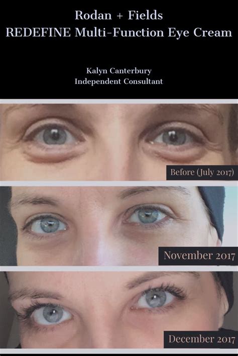 Hours may change under current circumstances Rodan + Fields eye cream and active Hydration bright eyes ...