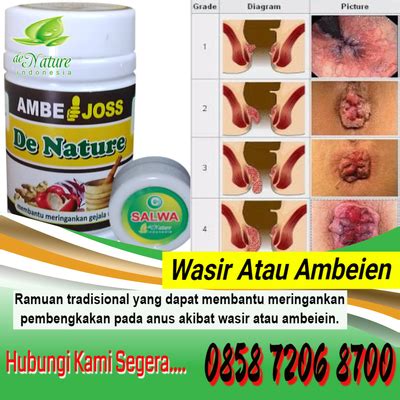 External,obat wasir efektif,obat untuk ambeien eksternal,obat ambeien faktu,obat ambeien facebook,obat ambeien faktu supp,obat ambeien farmasi pasca melahirkan,obat ambeien resep dokter,obat ambeien ringan,obat ambeien ramuan cina,obat ambeien rectal,obat ambeien rudal. Nama Obat Di Apotik Untuk Wasir