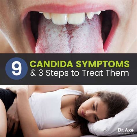 Listen to the audio pronunciation in several english accents. 9 Candida Symptoms & 3 Steps to Treat Them - Dr. Axe