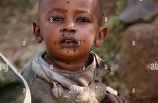 flies african face boy his ethiopia alamy young