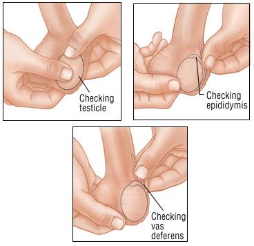 The first peak occurs before the age of 45 and accounts for about 90% of cases of testicular cancer. Testicular Cancer - Harvard Health