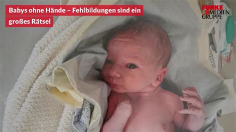 Babys ohne Hände: Contergan-Skandal sollte eine Lehre sein ...