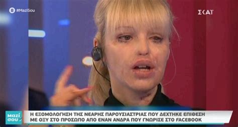 8:19 konstantina adamaki 60 077 просмотров. Η εξομολόγηση της Κέιτι Πάιπερ για την επίθεση με οξύ video