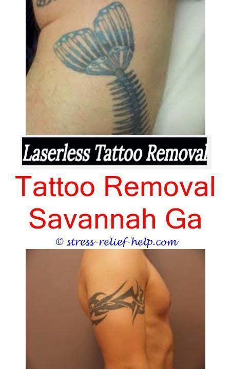 Mix 100 gm of salt in lemon juice and dip a cotton ball in this mixture. Does laser tattoo removal really hurt.How to remove ...