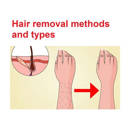 Shaving shaving is one of the cheapest and most easily accessible methods of removing hair because you can do it yourself in the shower—and it only takes an extra minute or two to cover large areas such as your legs. Hair removal methods and types