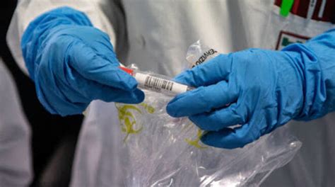 In genere, si consiglia caldamente di sospendere le terapie antibiotiche in atto per un certo periodo di tempo e di evitare l'utilizzo di collutori o medicamenti ad uso locale nelle ore che lo precedono. Tampone molecolare solidale a 35 euro al Duomo con Sadisa ...