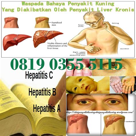 Selain itu, bayi yang mengalami penyakit kuning biasanya memiliki. obat penyakit kuning sangat ampuh 3 hari sembuh