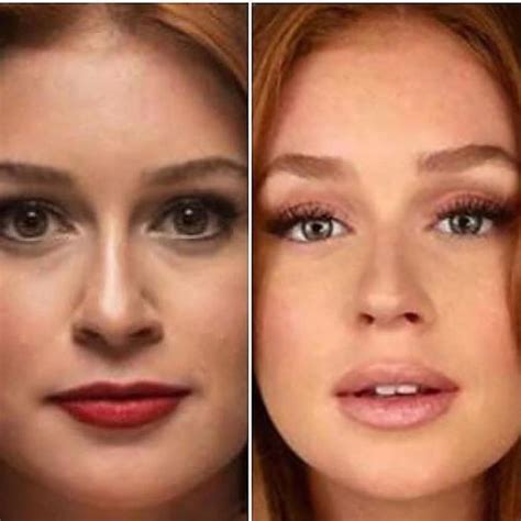Marina ruy barbosa sobe em vaso sanitário e manda recado importante; Dra. Aline Pagotti - E não é que é possível melhorar ainda ...