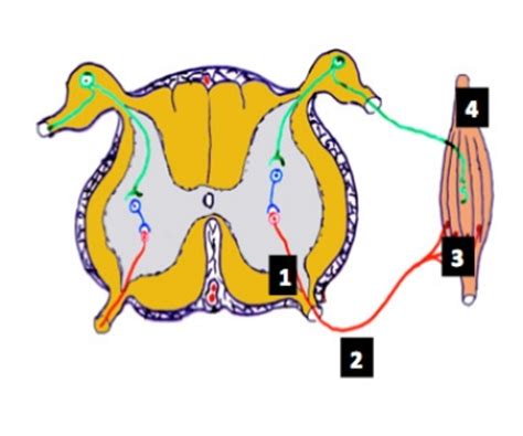 Las enfermedades olvidadas o desatendidas son un conjunto de enfermedades infecciosas, muchas de ellas parasitarias, que afectan principalmente a las poblaciones más pobres y con un limitado. Enfermedades Neuromusculares - Fisioterapia Neurológica