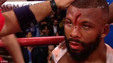 Browne loses point in seventh round for hitting on the break. Badou Jack suffers horror head injury during Marcus Browne ...