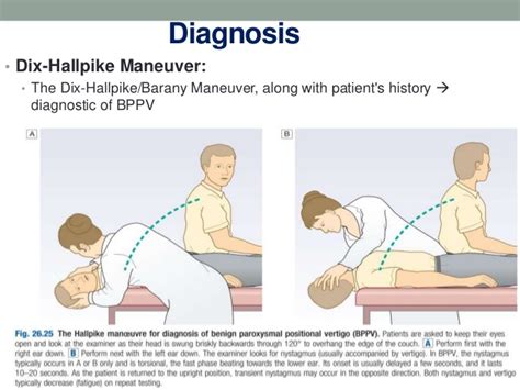 The cardinal symptom is sudden vertigo induced by a change in head position: Benign Paroxysmal Positional Vertigo (BPPV)