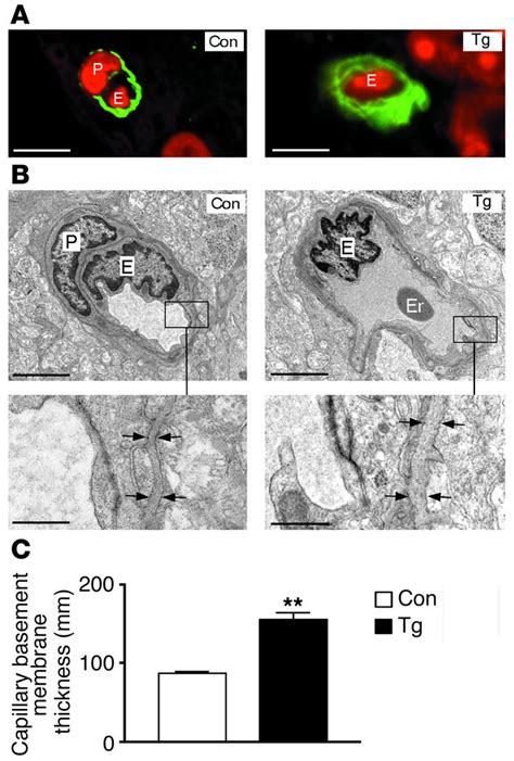 We did not find results for: JCI - Increased ocular levels of IGF-1 in transgenic mice ...