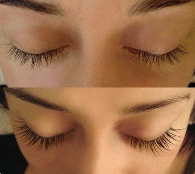 Diy essential oil eyelash growth serum. Health Secrets: Latisse an easy to use lash serum for ...