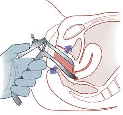 Differential diagnosis (the list of possible diagnoses, and the effort to. EUA | definition of EUA by Medical dictionary