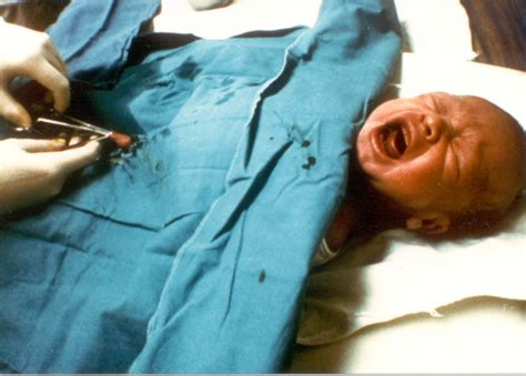 43 baby boy memes ranked in order of popularity and relevancy. Circumcision Not Cost-Effective Says Study