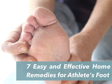 It is easiest to pick up the fungus in a state of vitamin deficiency, with reduced immunity and impaired. How to Cure Athlete's Foot Between Toes and Toenail Fungus ...