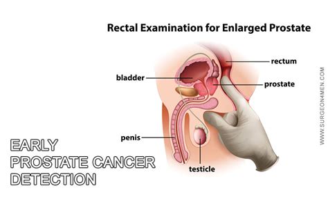This may be ruled by psa level in blood, as a rise in psa levels may be the first sign of the recurrence learning the early onset signs and symptoms of prostate cancer may help prevent invasive cancer treatment or help in making simple dietary and. Early Prostate Cancer Detection