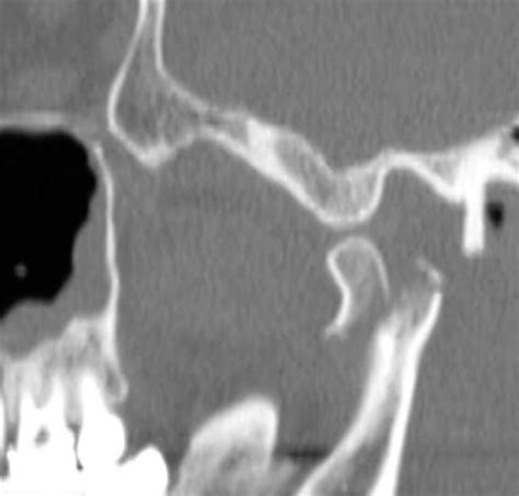 Radiodiagnostica - Sim. 008
