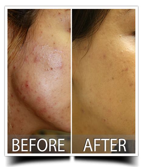 Skin Doctor for Laser treatment | hair removal | discoloration | wrinkle problems and treatment ...
