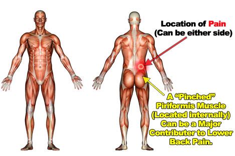 It could also be the area around your kidneys that is sore. Back Pain - 5 common causes and solutions - Better Body Group