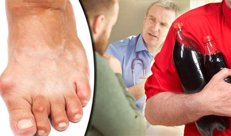 A gout diet isn't a cure. Gout diet: Reduce risk of painful symptoms avoiding ...