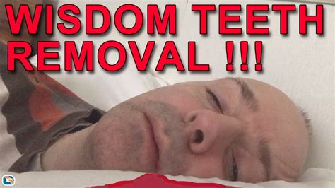 So, what can you do if your extraction site starts throbbing and keeping you awake at night? Wisdom Teeth Removal !!! #ChannelTalk - YouTube