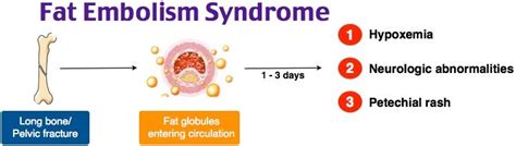 Precise medical treatment for fat embolism and fat embolism syndrome (fes) is not. FAT EMBOLISM - DNB Orthopaedics MS Orthopedics MRCS Exam ...